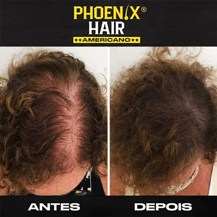 Antes e Depois