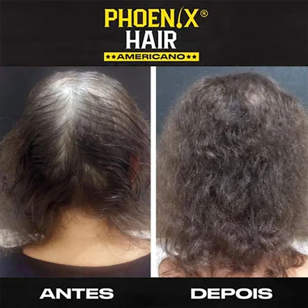 Antes e Depois