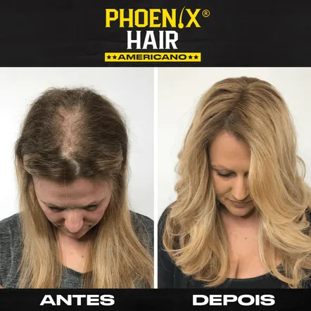 Antes e Depois